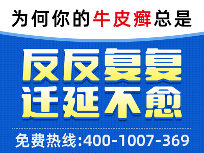 是什么原因导致的中老年牛皮癣